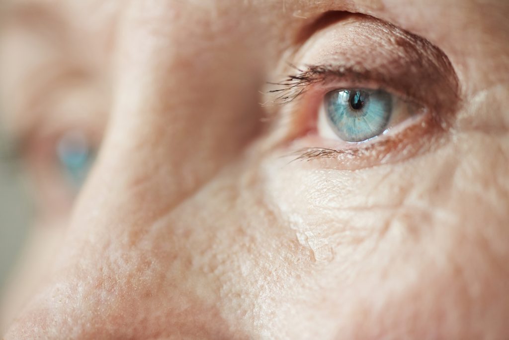 Degenerazione Maculare Legata all’Età